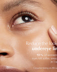 Estee Lauder: Advanced Night Repair Eye Concentrate Matrix Synchronized Multi-Recovery Complex - 15ml