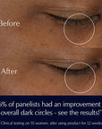 Estee Lauder: Advanced Night Repair Eye Supercharged Gel-Creme - 15ml