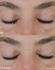 Shiseido Vital Perfection: Uplifting and Firming Eye Cream - 15ml