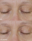 Shiseido Vital Perfection: Uplifting and Firming Eye Cream - 15ml