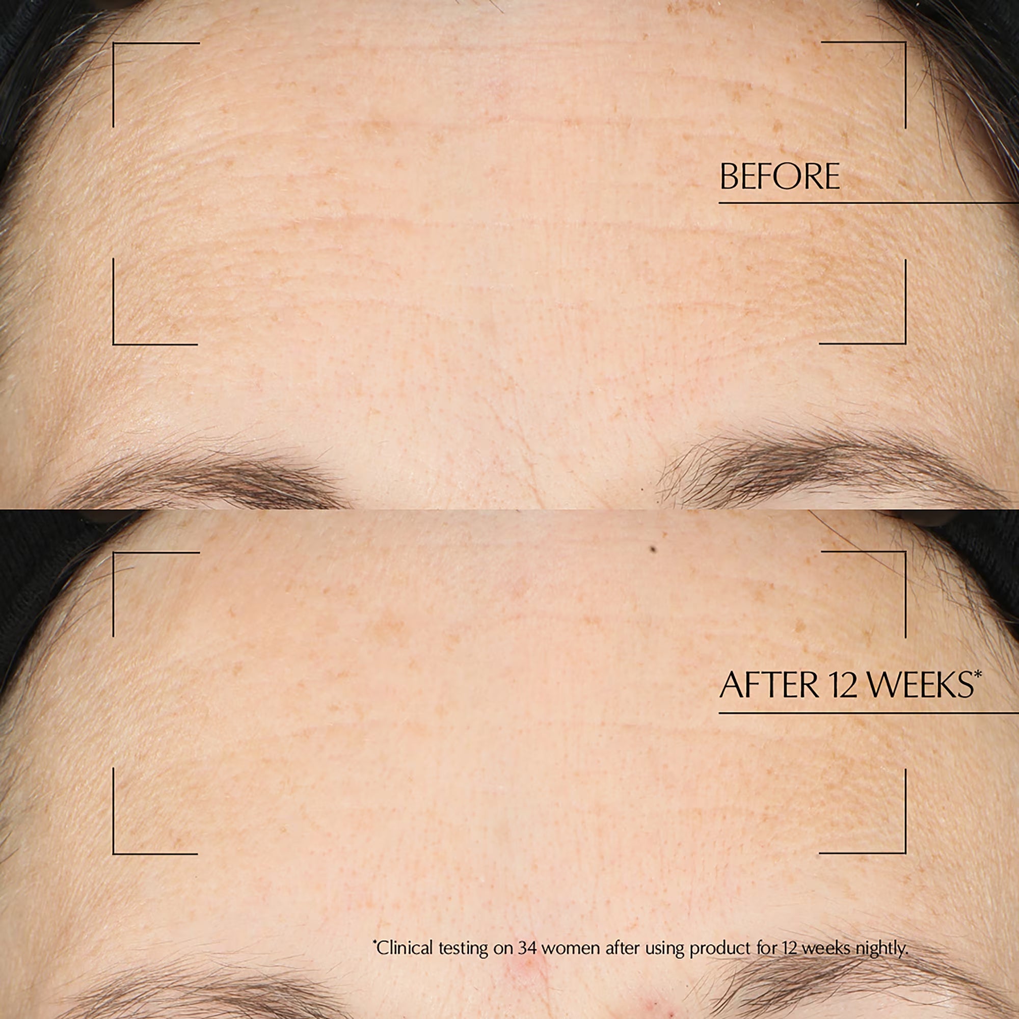 Estee Lauder: Advanced Night Repair Overnight Treatment - 65ml