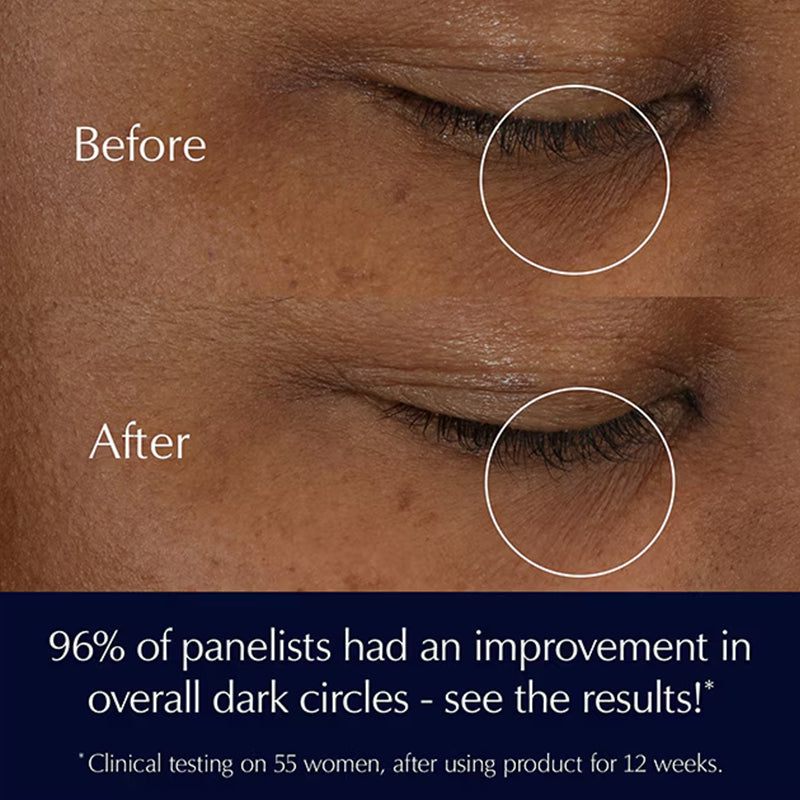 Estee Lauder: Advanced Night Repair Eye Supercharged Gel-Creme - 15ml