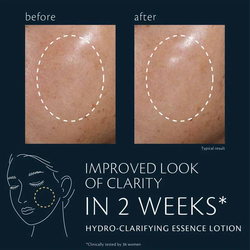 Clé de Peau Beauté: Hydro-Clarifying Lotion – 170 ml