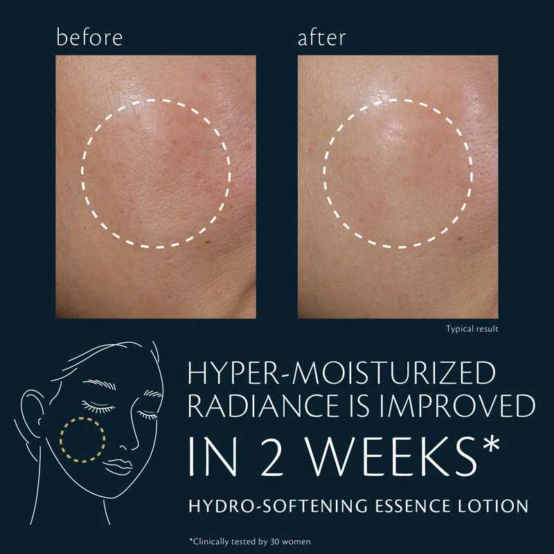 Clé de Peau Beauté: Hydro-Softening Lotion – 170 ml