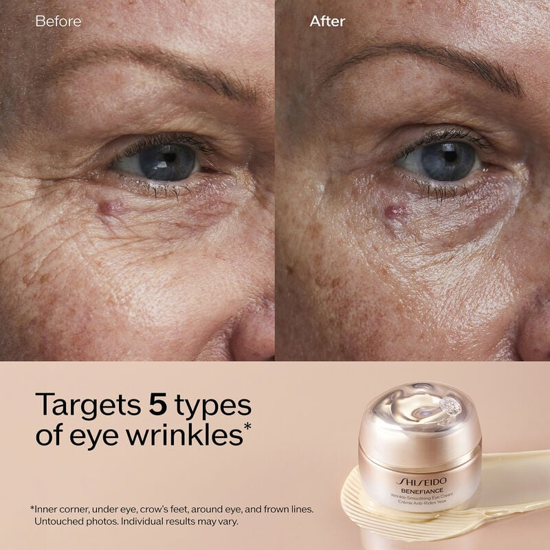 Shiseido Benefiance: Wrinkle Smoothing Eye Cream - 15ml