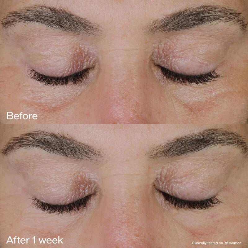 Shiseido Vital Perfection: Uplifting and Firming Eye Cream - 15ml