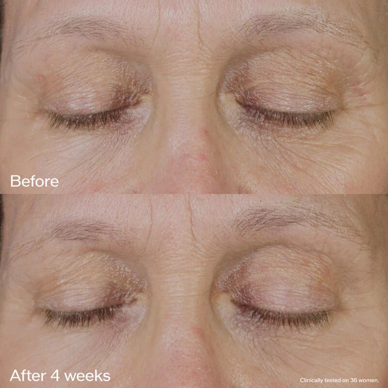 Shiseido Vital Perfection: Uplifting and Firming Eye Cream - 15ml